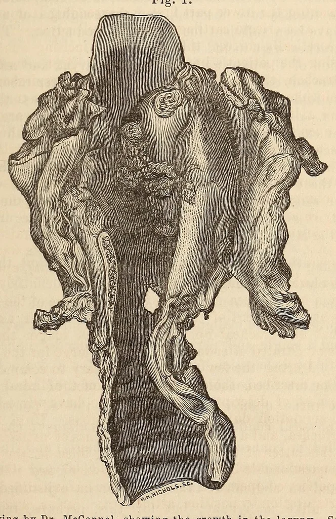 An illustration from The American journal of the medical sciences, 1827, leaf 407