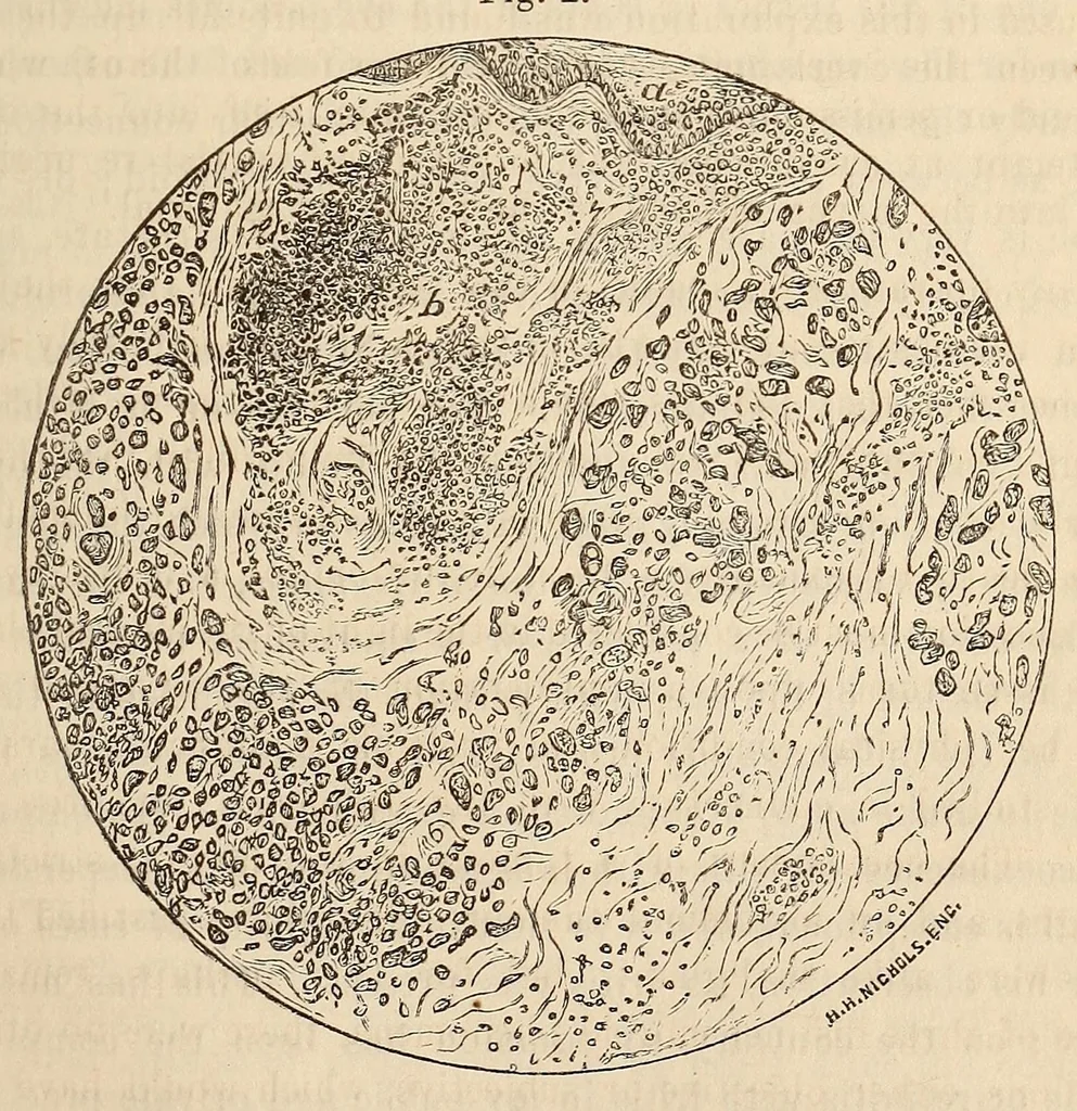 An illustration from The American journal of the medical sciences, 1827, leaf 409