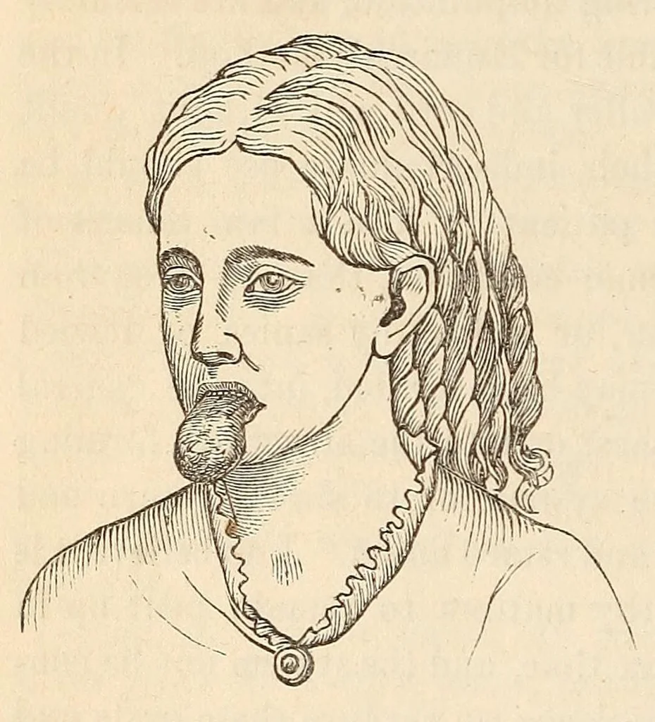 An illustration from The American journal of the medical sciences, 1827, leaf 428