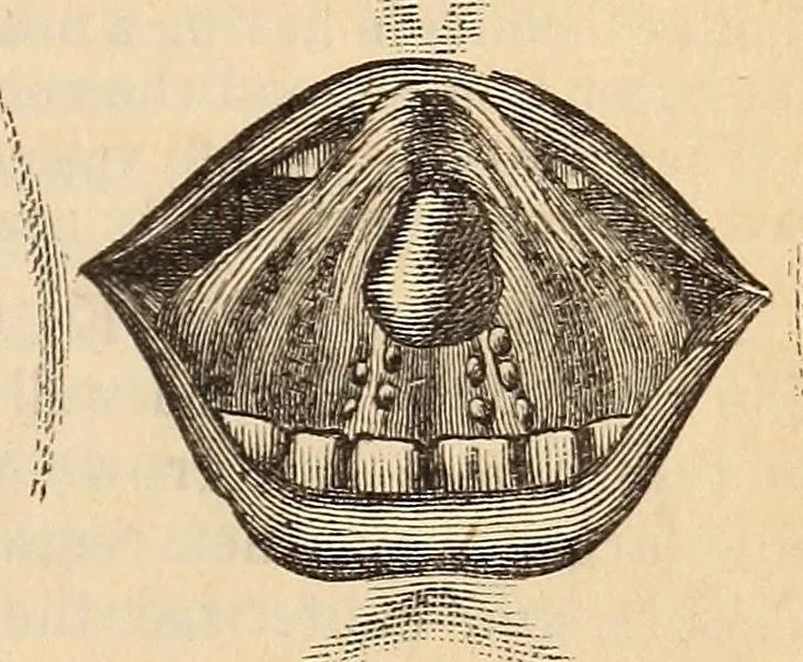 An illustration from The American journal of the medical sciences, 1827, leaf 455