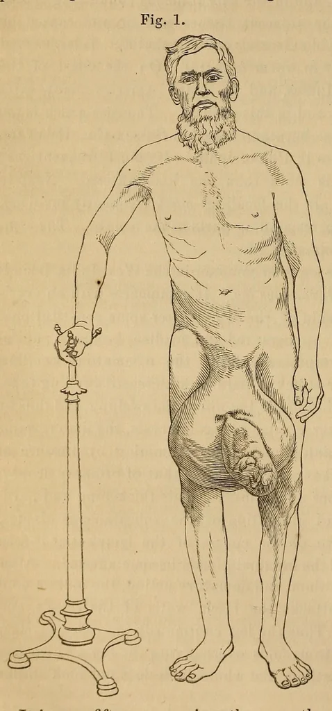 An illustration from The American journal of the medical sciences, 1827, leaf 120