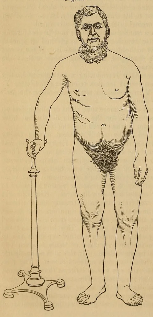 An illustration from The American journal of the medical sciences, 1827, leaf 122
