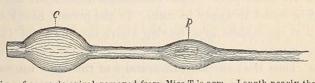 An illustration from The American journal of the medical sciences, 1827, leaf 327