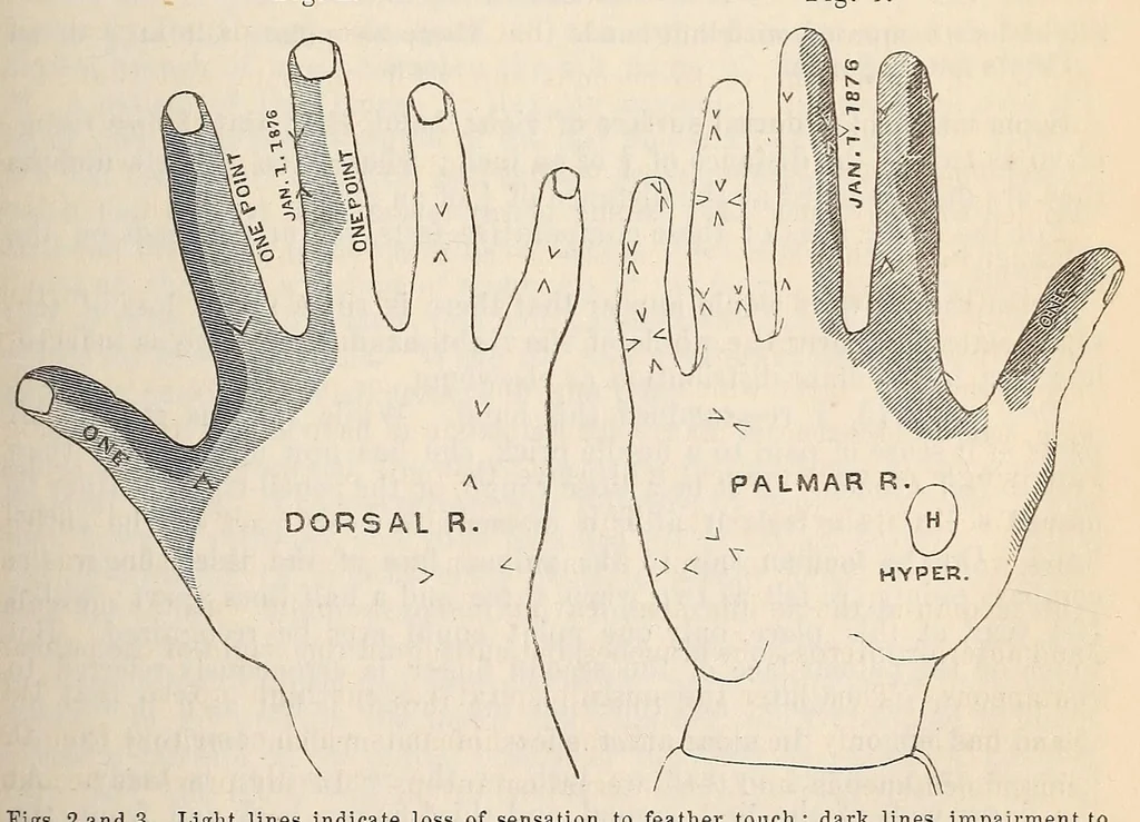 An illustration from The American journal of the medical sciences, 1827, leaf 329