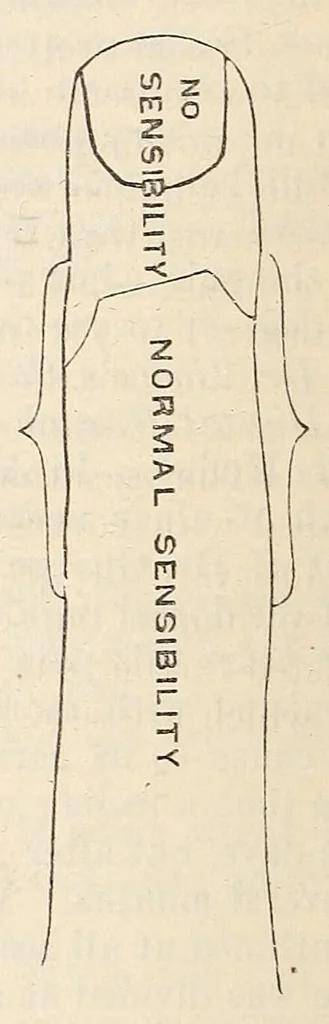 An illustration from The American journal of the medical sciences, 1827, leaf 332