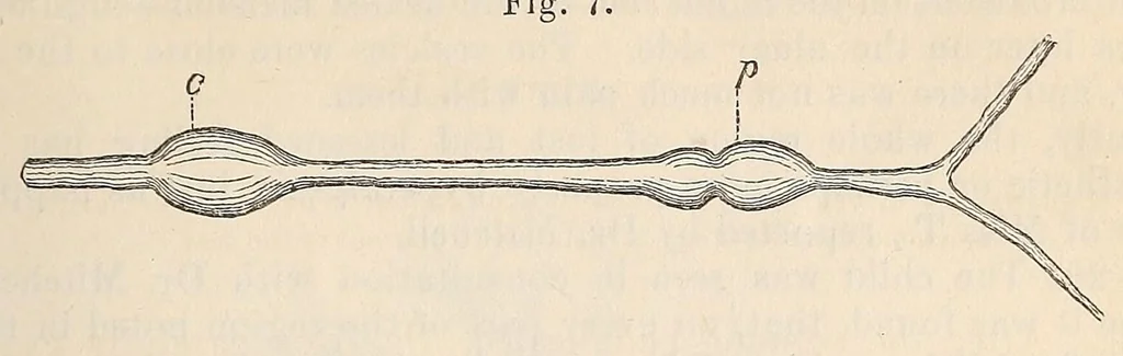 An illustration from The American journal of the medical sciences, 1827, leaf 333