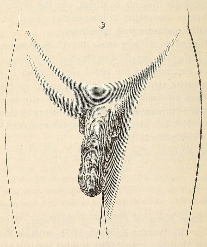 An illustration from The American journal of the medical sciences, 1827, leaf 412