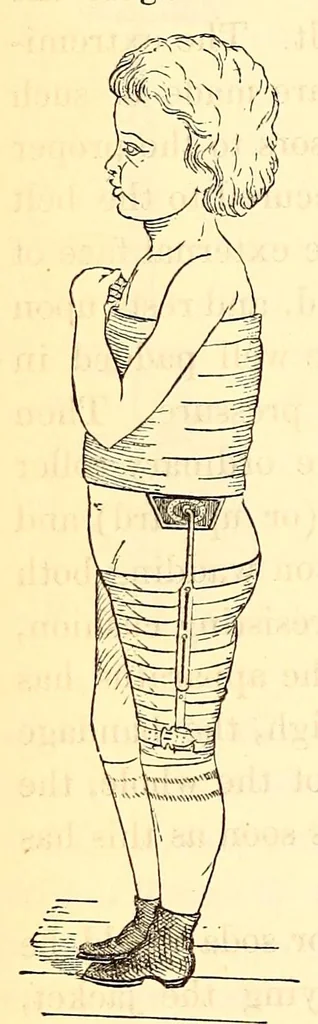 An illustration from The American journal of the medical sciences, 1827, leaf 130