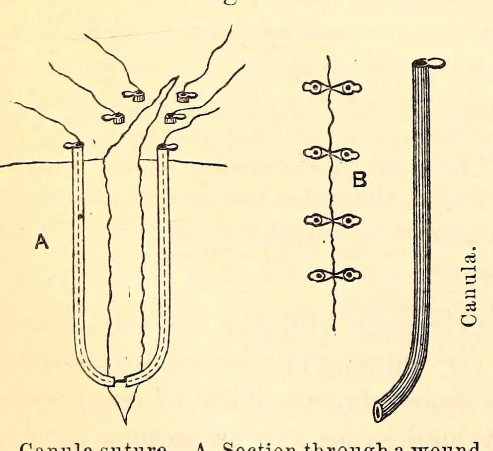 An illustration from The American journal of the medical sciences, 1827, leaf 452