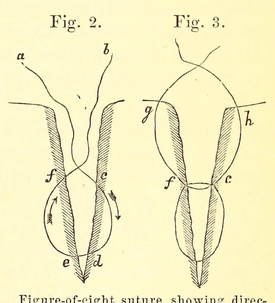 An illustration from The American journal of the medical sciences, 1827, leaf 453
