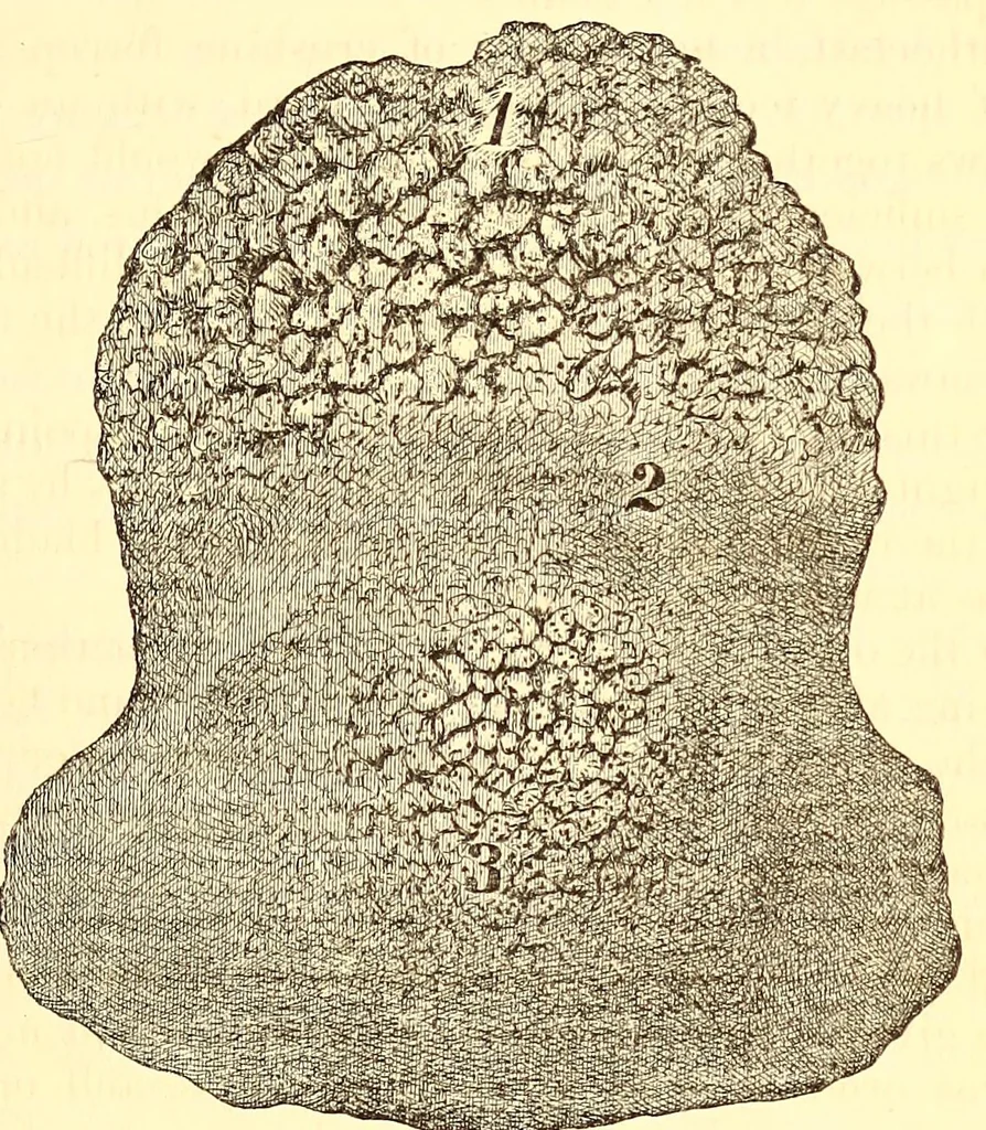 An illustration from The American journal of the medical sciences, 1827, leaf 461
