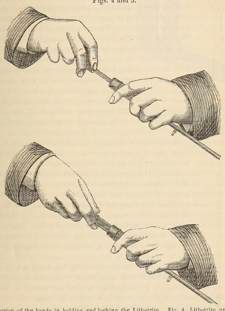 An illustration from The American journal of the medical sciences, 1827, leaf 131