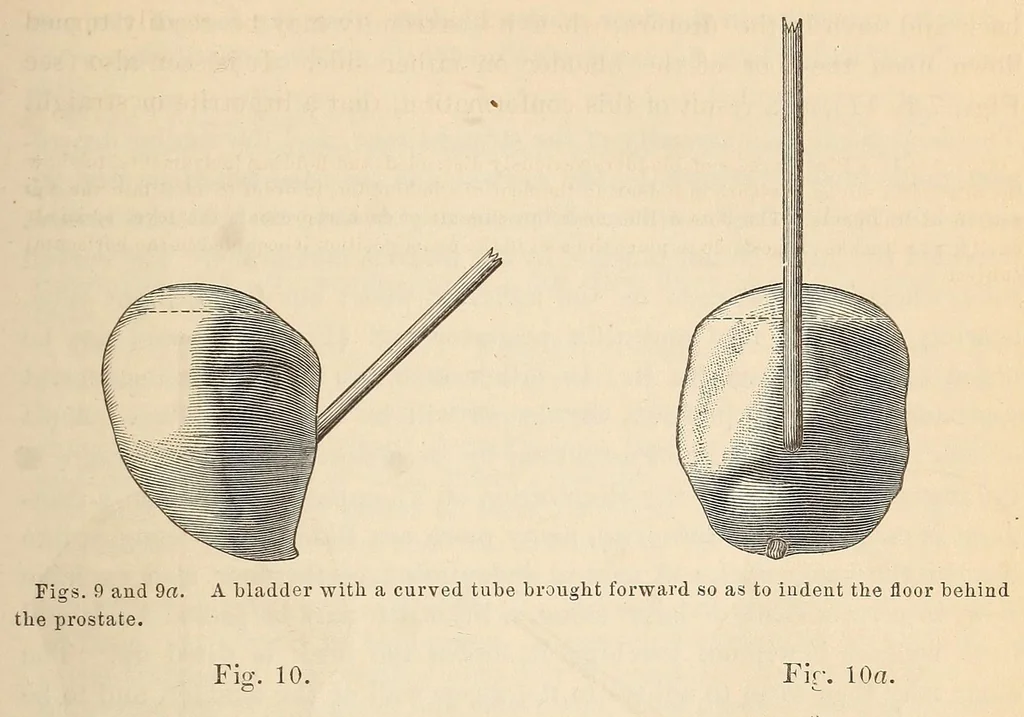 An illustration from The American journal of the medical sciences, 1827, leaf 135