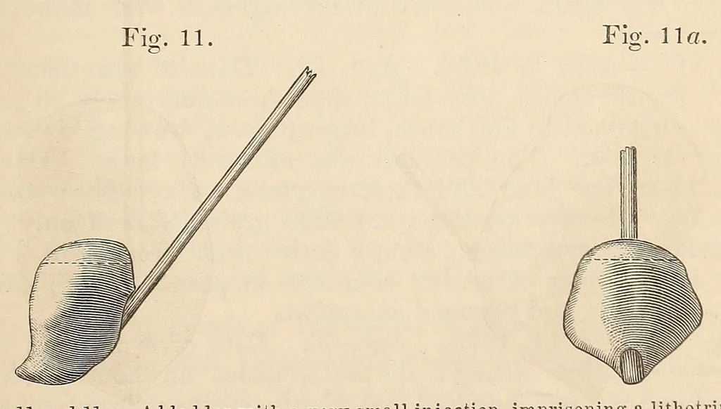 An illustration from The American journal of the medical sciences, 1827, leaf 135