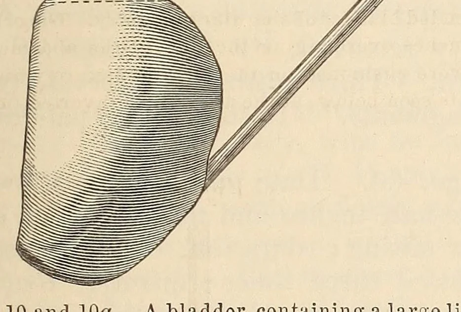 An illustration from The American journal of the medical sciences, 1827, leaf 135