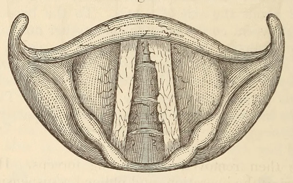 An illustration from The American journal of the medical sciences, 1827, leaf 142