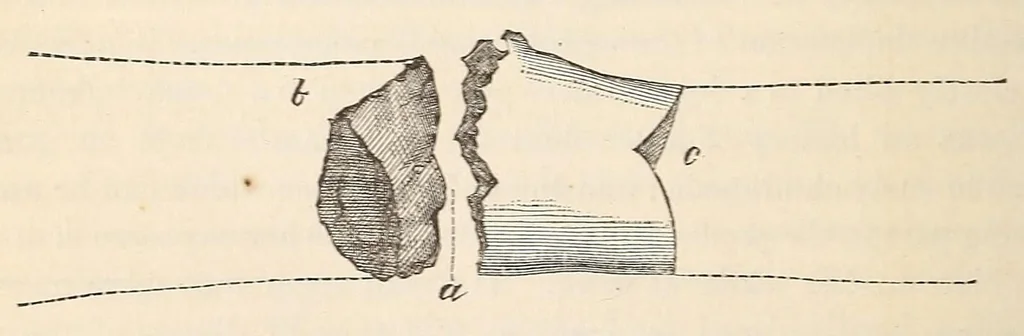 An illustration from The American journal of the medical sciences, 1827, leaf 434