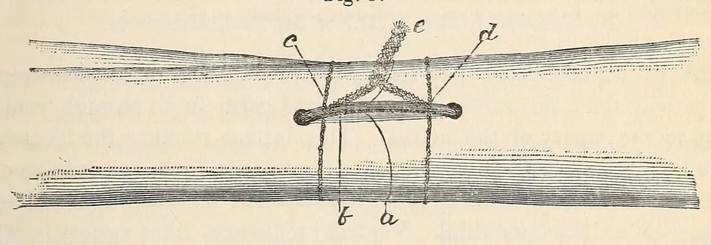 An illustration from The American journal of the medical sciences, 1827, leaf 435