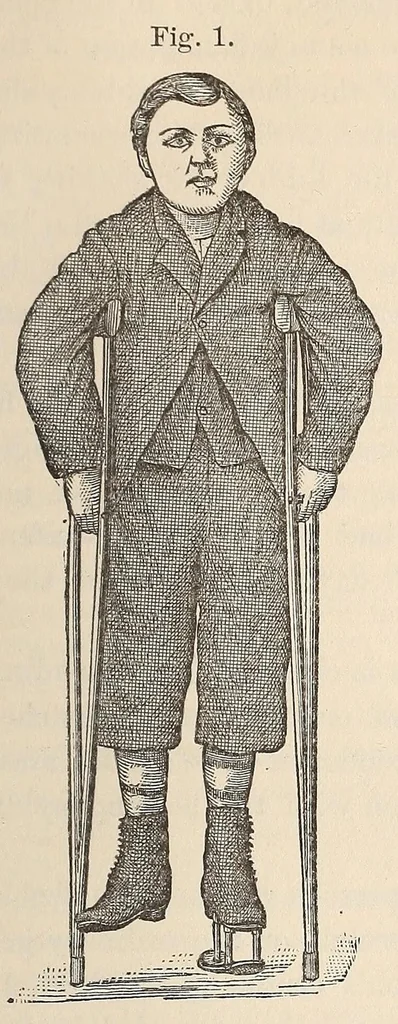 An illustration from The American journal of the medical sciences, 1827, leaf 71