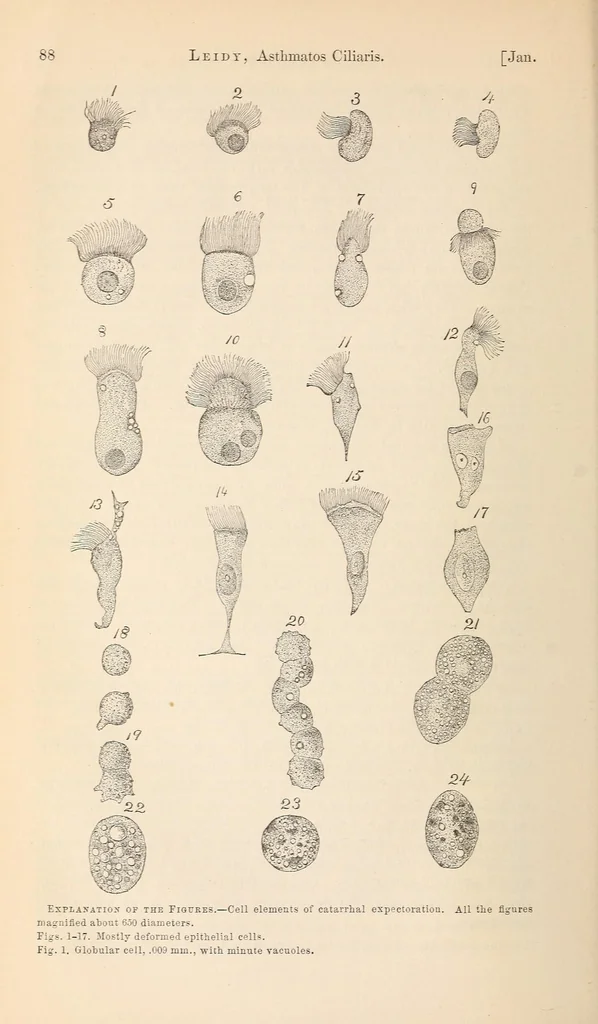 An illustration from The American journal of the medical sciences, 1827, leaf 92