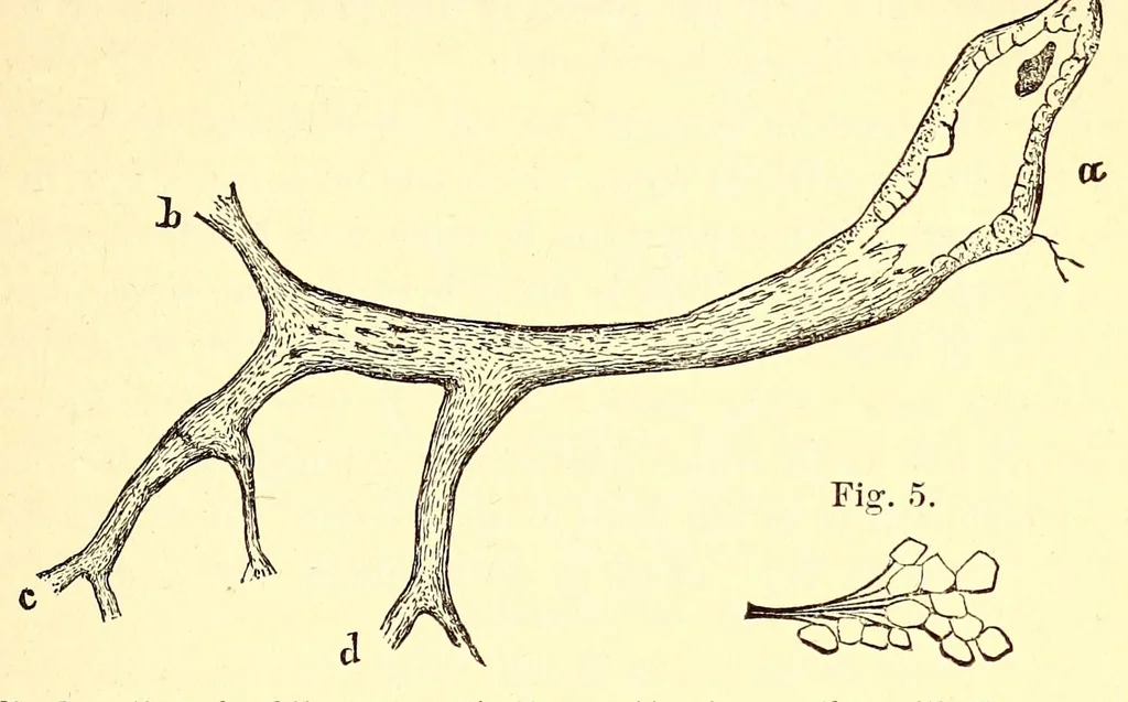 An illustration from The American journal of the medical sciences, 1827, leaf 135