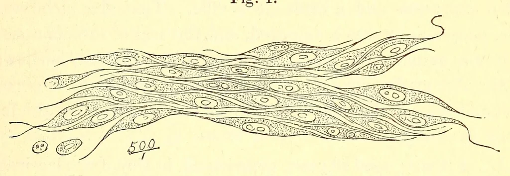 An illustration from The American journal of the medical sciences, 1827, leaf 341