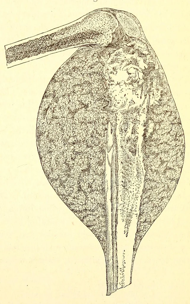 An illustration from The American journal of the medical sciences, 1827, leaf 371