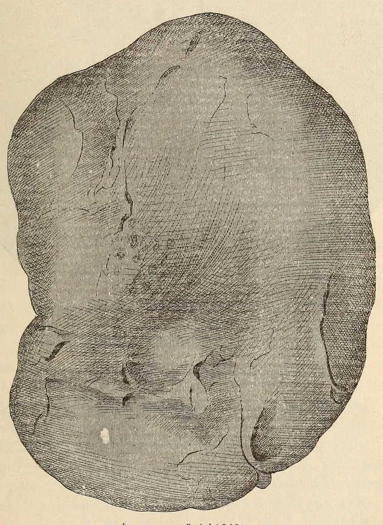 An illustration from The American journal of the medical sciences, 1827, leaf 153