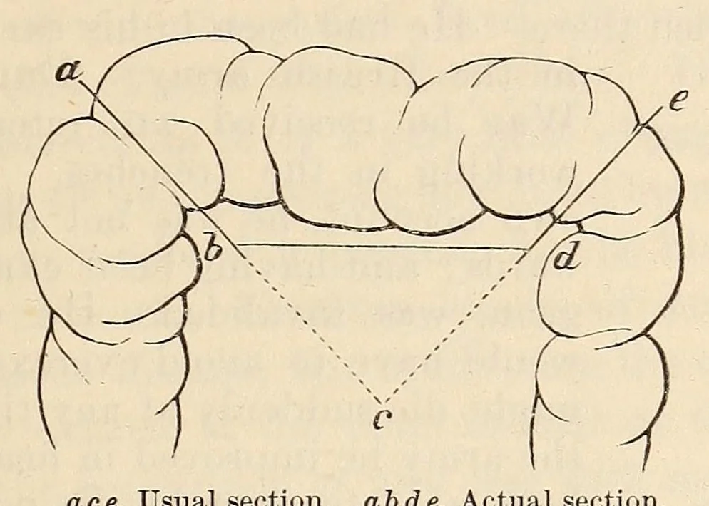 An illustration from The American journal of the medical sciences, 1827, leaf 161