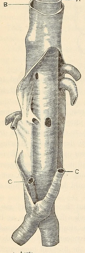 An illustration from The American journal of the medical sciences, 1827, leaf 162