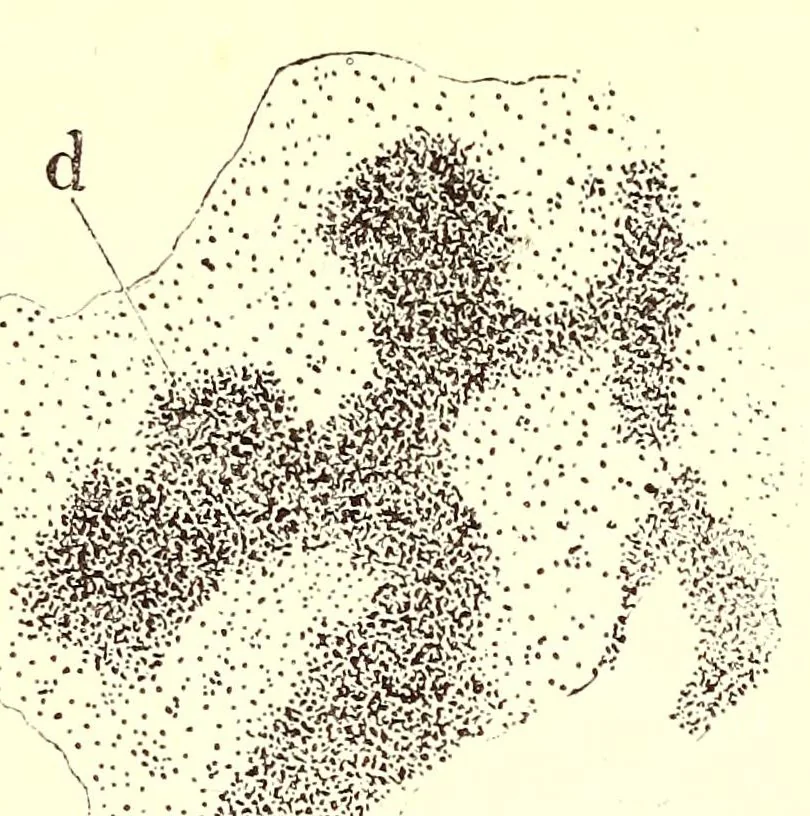 An illustration from The American journal of the medical sciences, 1827, leaf 34