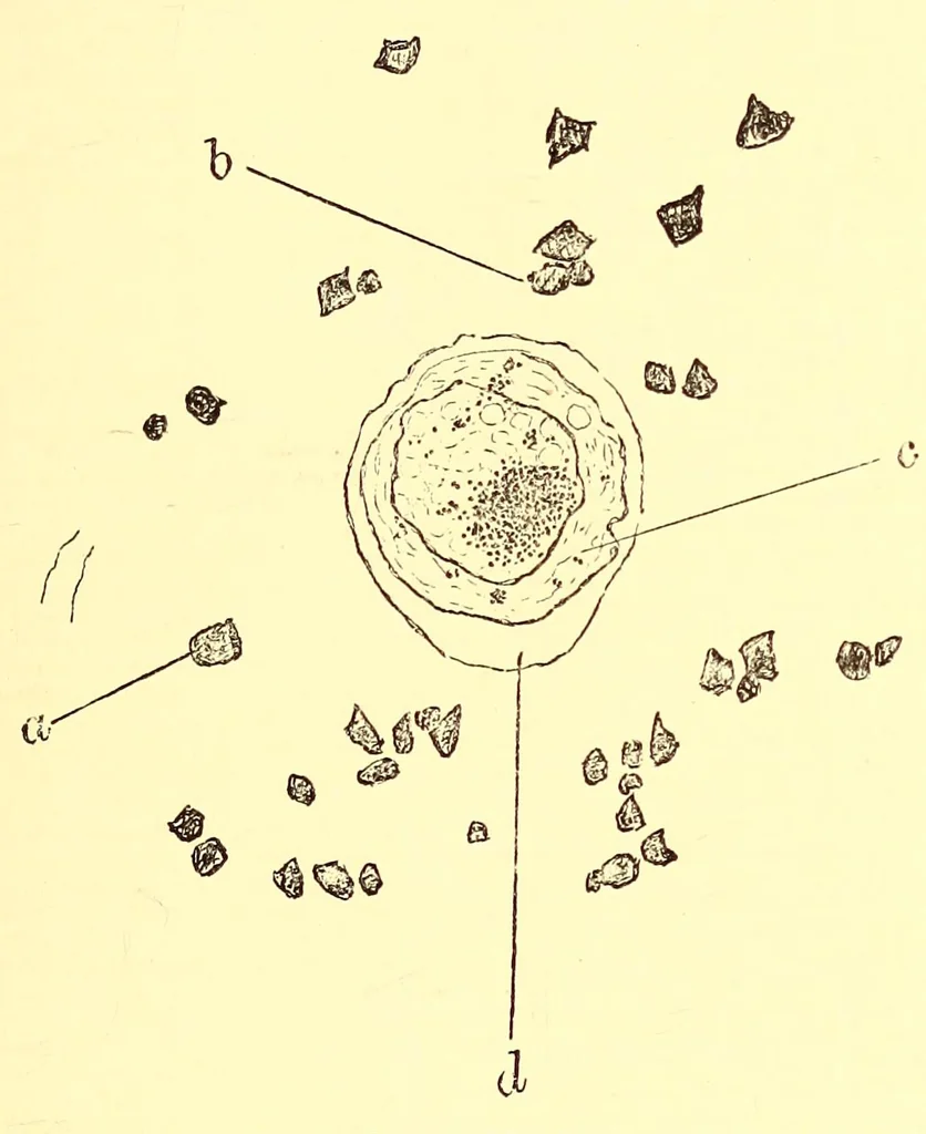 An illustration from The American journal of the medical sciences, 1827, leaf 35