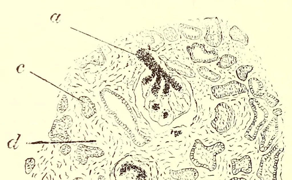 An illustration from The American journal of the medical sciences, 1827, leaf 38