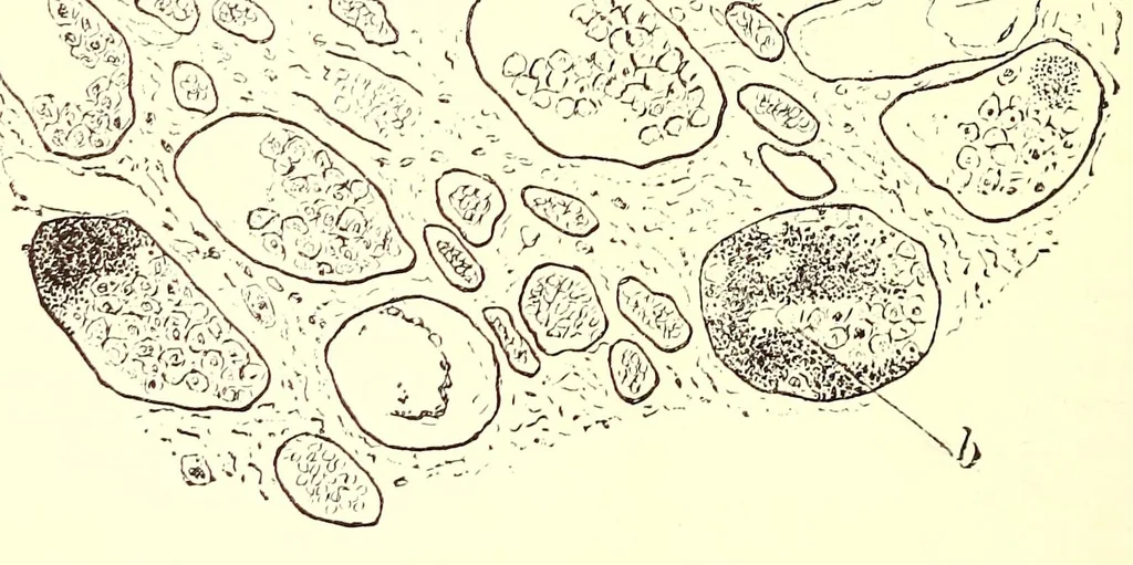 An illustration from The American journal of the medical sciences, 1827, leaf 42