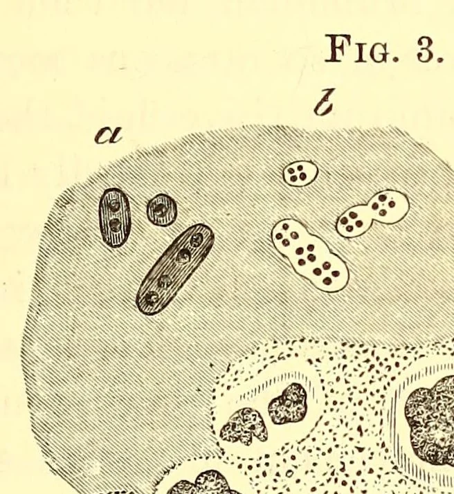 An illustration from The American journal of the medical sciences, 1827, leaf 77