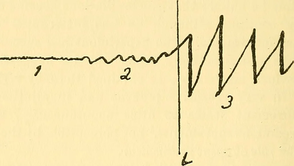 An illustration from Analytical psychology, 1916, leaf 75