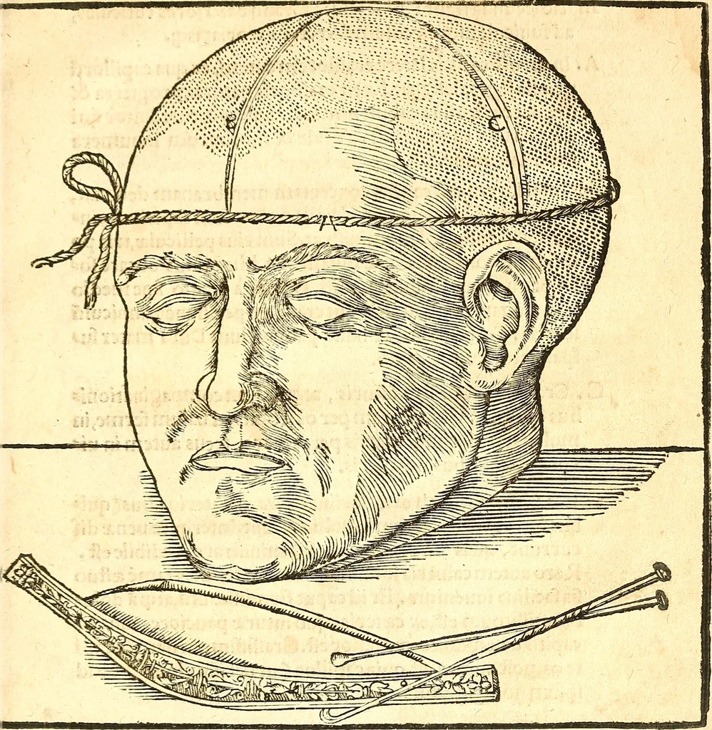 An illustration from Anatomiae, hoc est, corporis humani dissectionis pars prior, in qua singula quae ad caput spectant recensentur membra atque singulae partes, singulis suis ad uiuum commodissimè expressis figuris, deliniantur, 1537, leaf 32