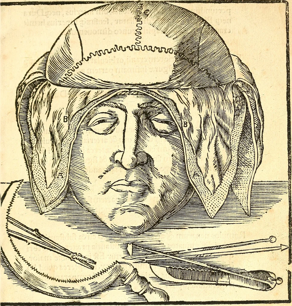 An illustration from Anatomiae, hoc est, corporis humani dissectionis pars prior, in qua singula quae ad caput spectant recensentur membra atque singulae partes, singulis suis ad uiuum commodissimè expressis figuris, deliniantur, 1537, leaf 34