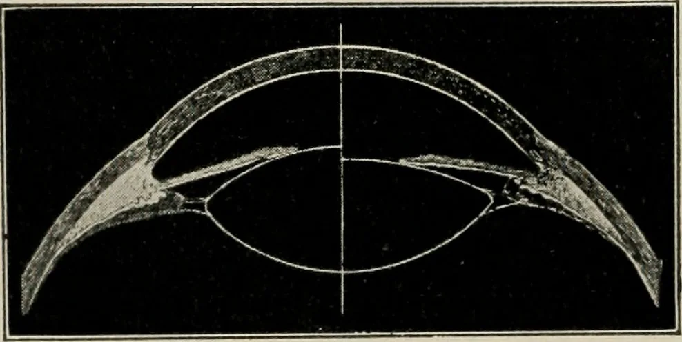 An illustration from Anatomy and physiology of the eye, with hints for the preservation of the eyesight, 1901, leaf 31