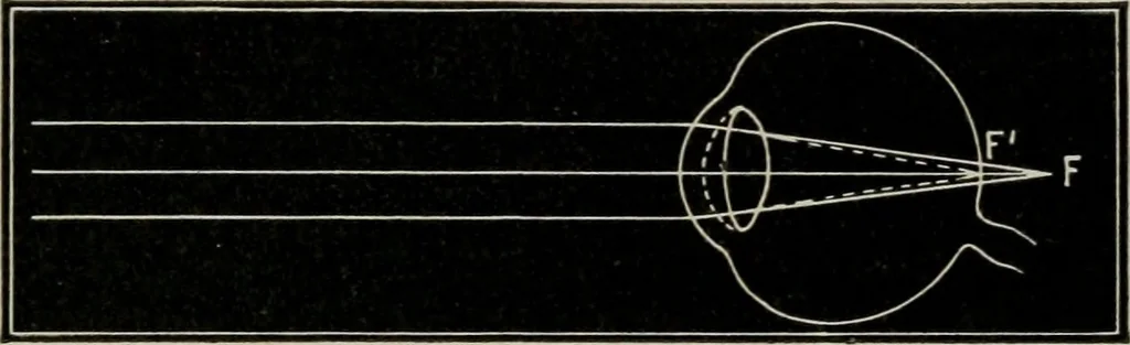 An illustration from Anatomy and physiology of the eye, with hints for the preservation of the eyesight, 1901, leaf 32