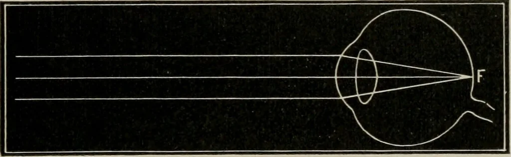 An illustration from Anatomy and physiology of the eye, with hints for the preservation of the eyesight, 1901, leaf 34