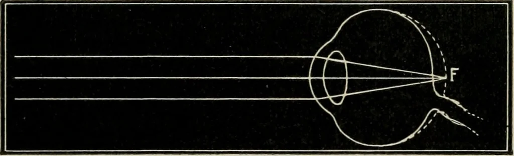 An illustration from Anatomy and physiology of the eye, with hints for the preservation of the eyesight, 1901, leaf 35