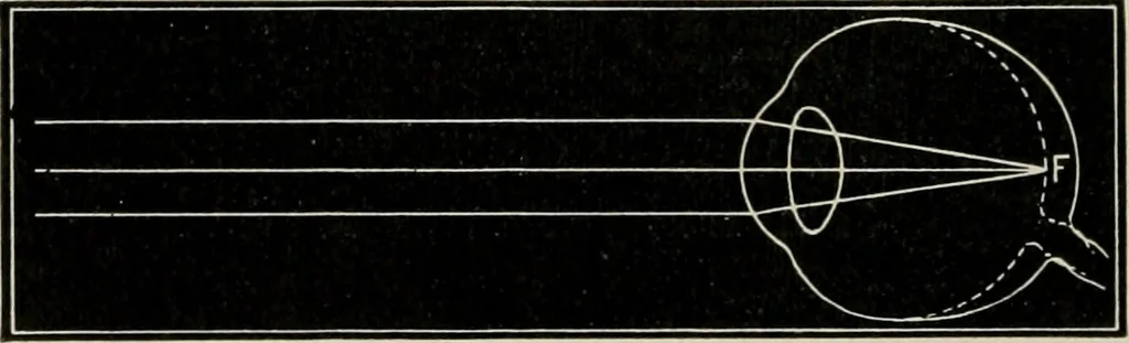 An illustration from Anatomy and physiology of the eye, with hints for the preservation of the eyesight, 1901, leaf 37