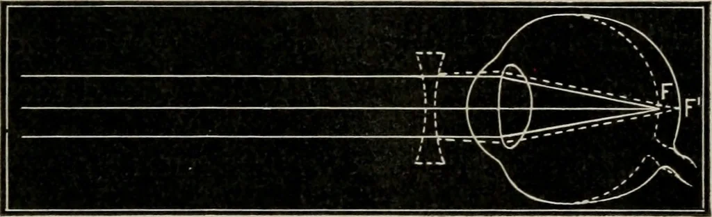 An illustration from Anatomy and physiology of the eye, with hints for the preservation of the eyesight, 1901, leaf 38