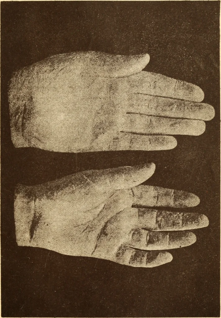 An illustration from Animismus und spiritismus. Versuch einer kritischen prüfung der mediumistischen phänomene mit besonderer berücksichtigung der hypothesen der hallucination und des unbewussten. Als entgegnung auf Ed. v. Hartmann's Werk: "Der spiritismus.", 1894, leaf 408