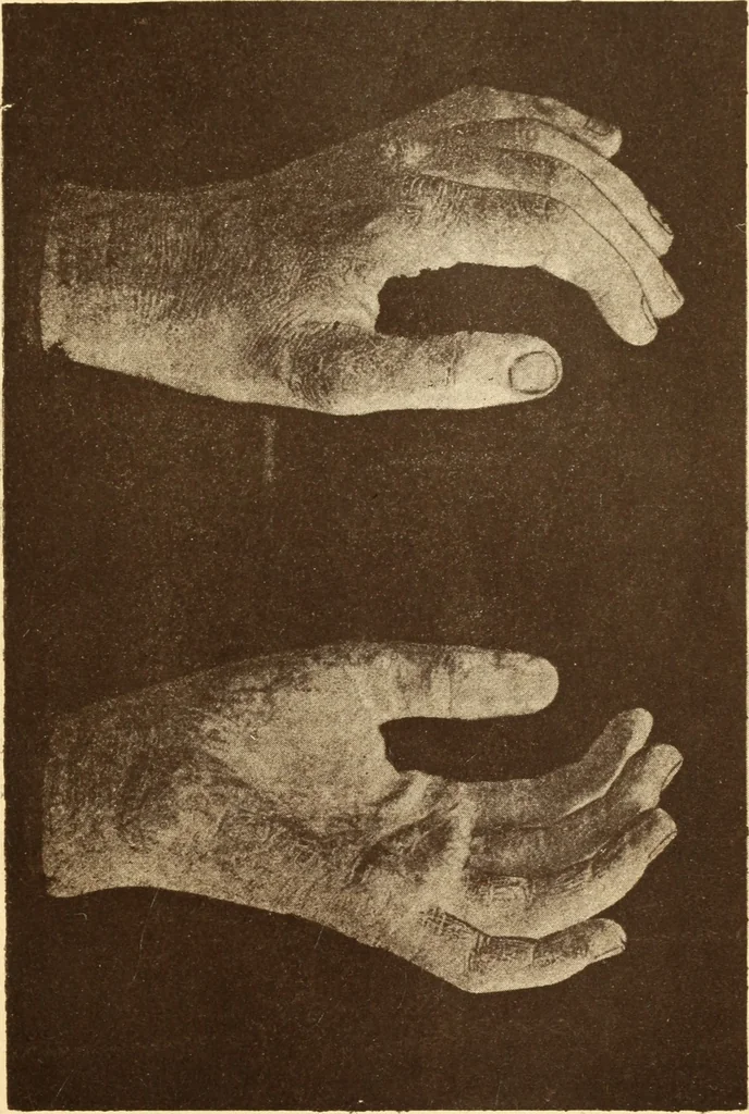 An illustration from Animismus und spiritismus. Versuch einer kritischen prüfung der mediumistischen phänomene mit besonderer berücksichtigung der hypothesen der hallucination und des unbewussten. Als entgegnung auf Ed. v. Hartmann's Werk: "Der spiritismus.", 1894, leaf 410