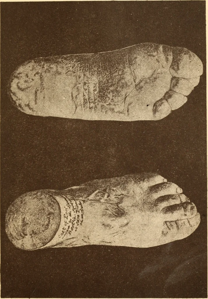 An illustration from Animismus und spiritismus. Versuch einer kritischen prüfung der mediumistischen phänomene mit besonderer berücksichtigung der hypothesen der hallucination und des unbewussten. Als entgegnung auf Ed. v. Hartmann's Werk: "Der spiritismus.", 1894, leaf 412