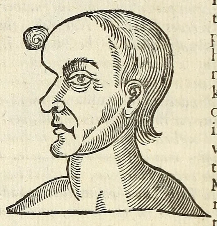 An illustration from Anthropometamorphosis: man transform'd: or, The artificiall changling, historically presented, in the mad and cruel gallantry, foolish bravery, ridiculous beauty, filthy finenesse, and loathsome loveliness of most nations, fashioning and altering their bodies from the mould intended by nature; with figures of those transformations. To which artificial and affected deformations are added, all the native and national monstrosities that have appeared to disfigure the humane fabrick. With a vindication of the regular beauty and honesty of nature, 1653, leaf 136