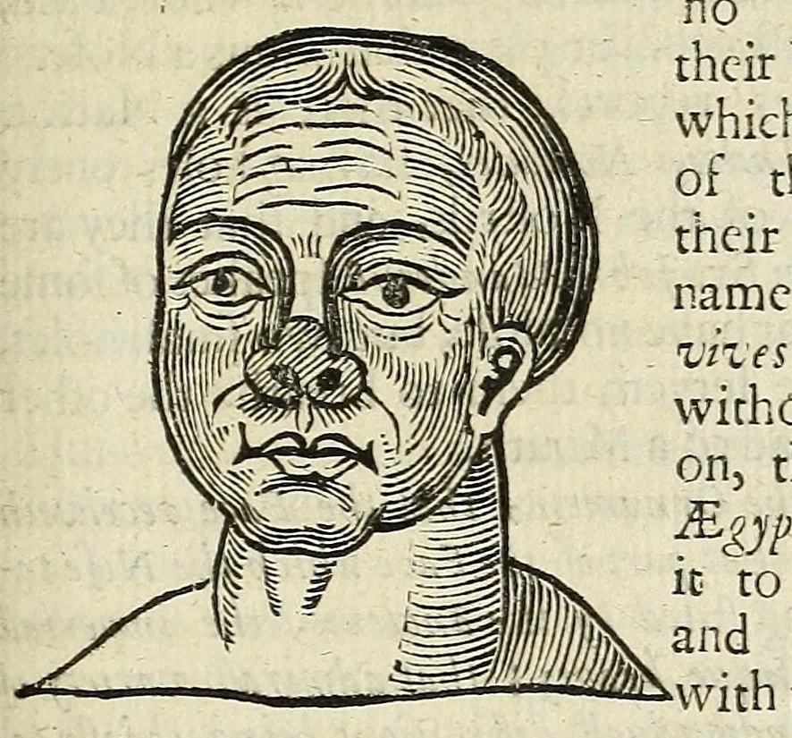 An illustration from Anthropometamorphosis: man transform'd: or, The artificiall changling, historically presented, in the mad and cruel gallantry, foolish bravery, ridiculous beauty, filthy finenesse, and loathsome loveliness of most nations, fashioning and altering their bodies from the mould intended by nature; with figures of those transformations. To which artificial and affected deformations are added, all the native and national monstrosities that have appeared to disfigure the humane fabrick. With a vindication of the regular beauty and honesty of nature, 1653, leaf 171