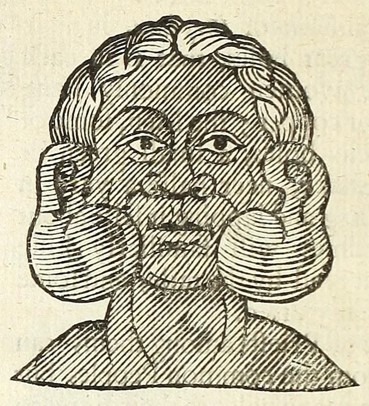 An illustration from Anthropometamorphosis: man transform'd: or, The artificiall changling, historically presented, in the mad and cruel gallantry, foolish bravery, ridiculous beauty, filthy finenesse, and loathsome loveliness of most nations, fashioning and altering their bodies from the mould intended by nature; with figures of those transformations. To which artificial and affected deformations are added, all the native and national monstrosities that have appeared to disfigure the humane fabrick. With a vindication of the regular beauty and honesty of nature, 1653, leaf 210
